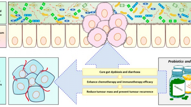 Gut Microbiota and Tumorigenesis