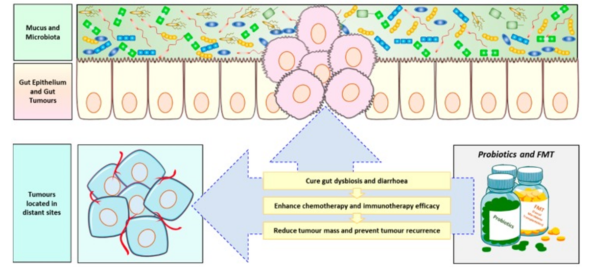 Gut Microbiota and Tumorigenesis