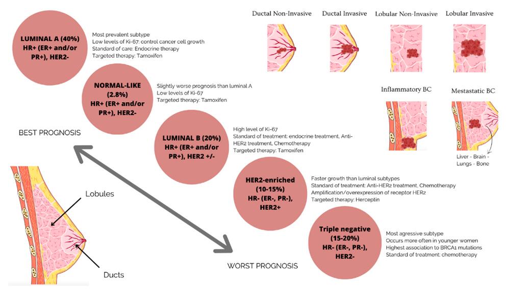 BC subgroups are based on molecular and histological characteristics