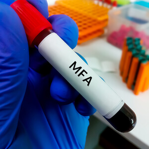 Lectin Microarray Assay