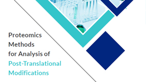 Proteomics Methods for Analysis of Post-Translational Modifications