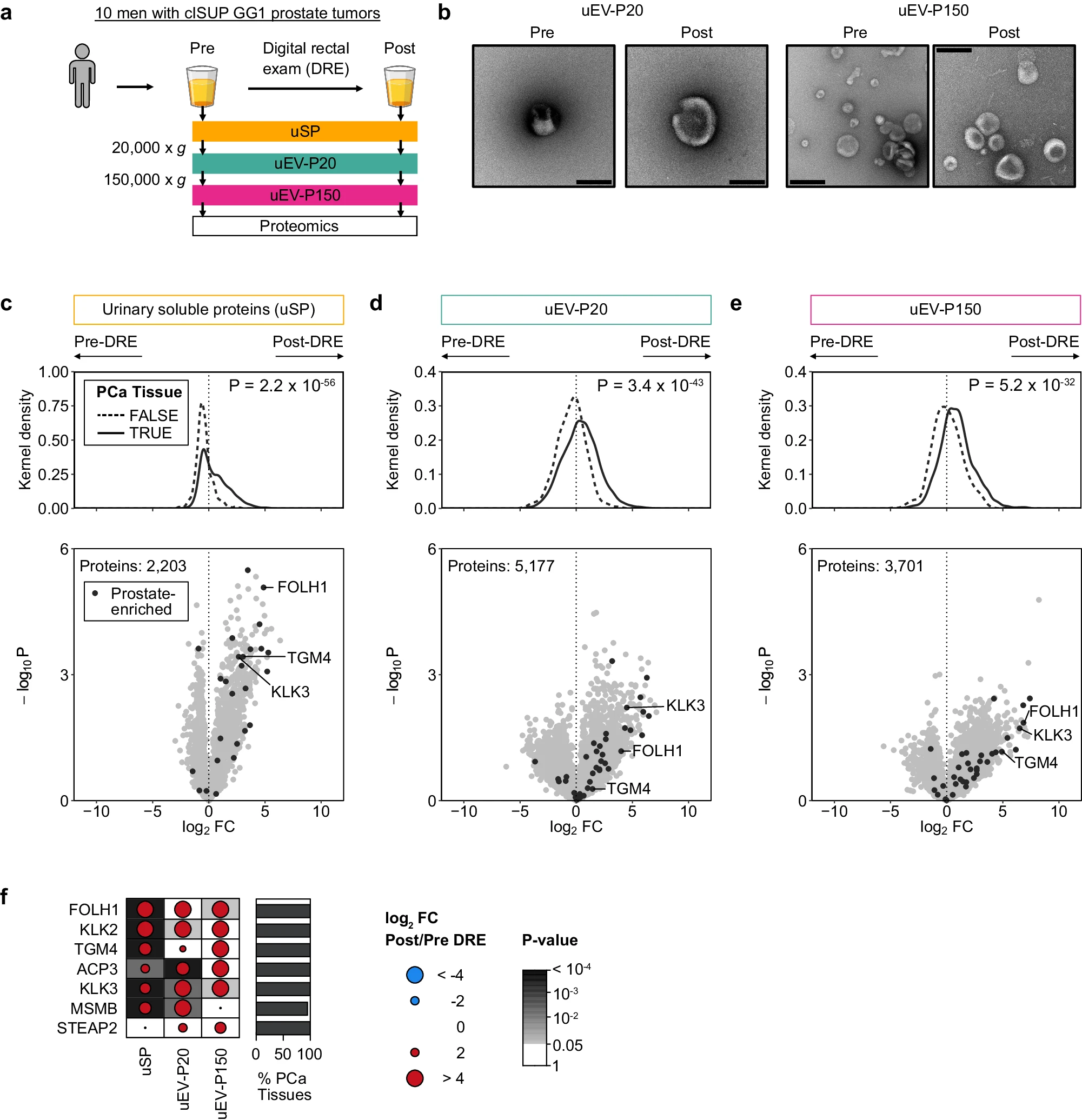 DRE enrichment of prostate proteins in paired urine samples