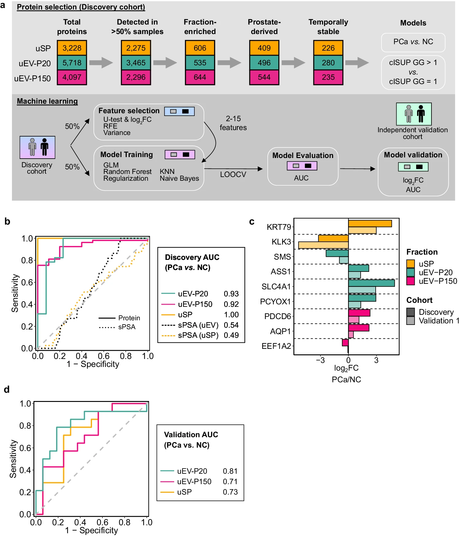 Multiprotein classifier distinguishes prostate cancer from benign lesions: AUC 0.92-1