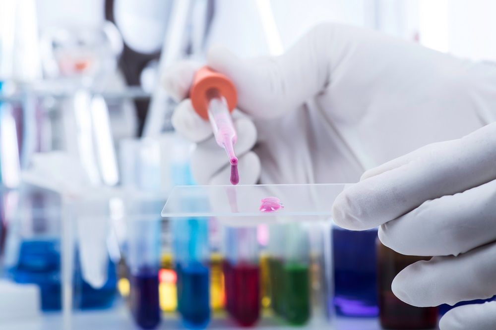 Peptide Sample Pre-Processing Services