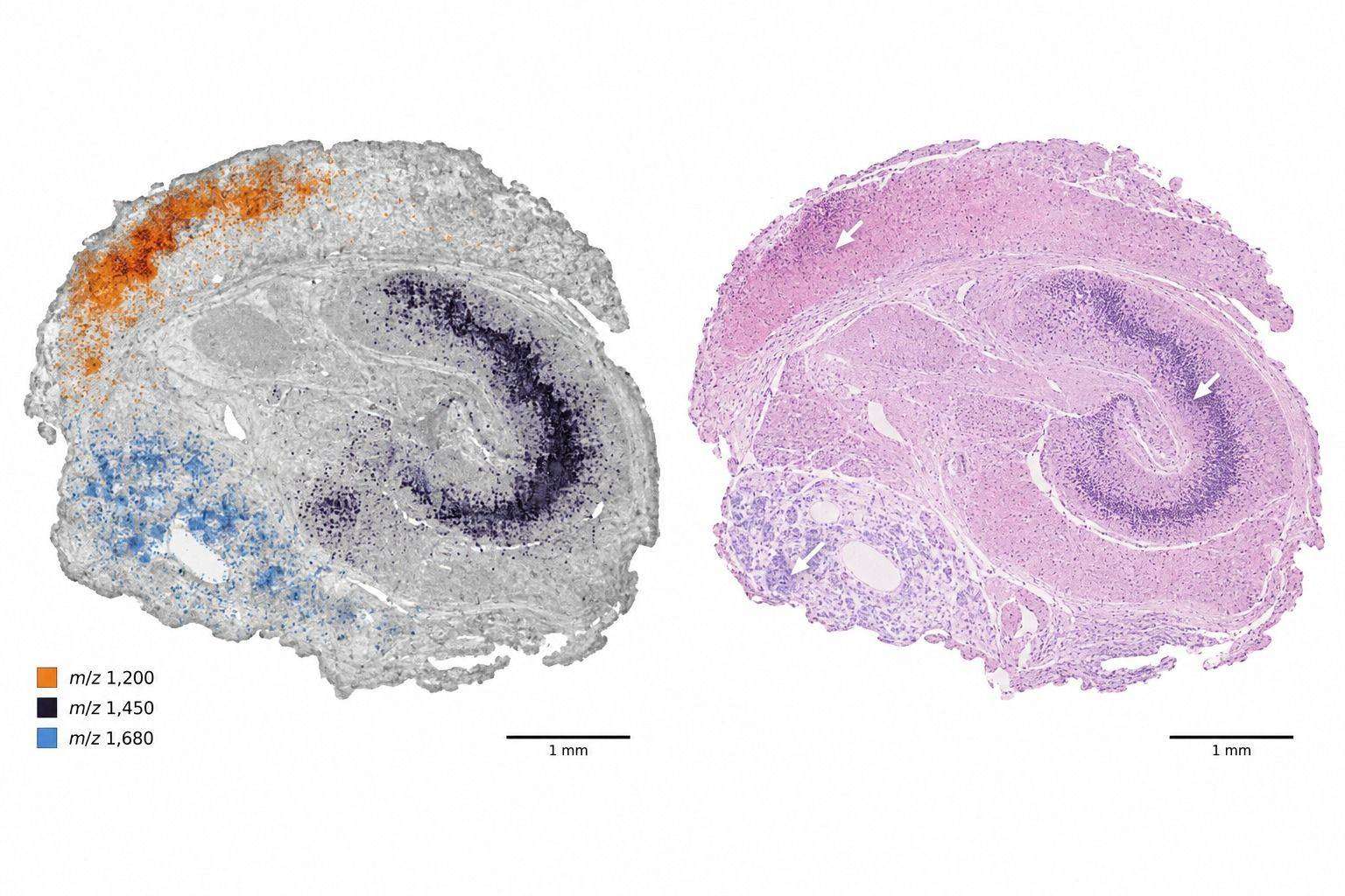 Representative MALDI-MSI ion images of peptide-range m/z features co-registered with tissue histology