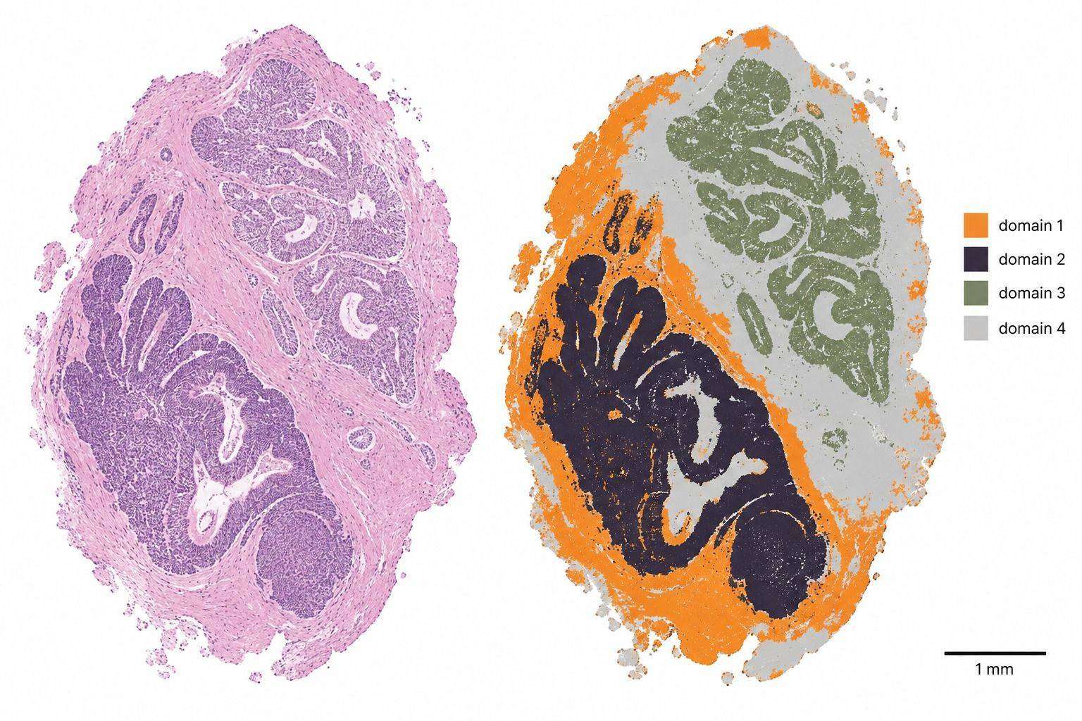 Representative spatial segmentation of a tissue section into molecularly distinct domains