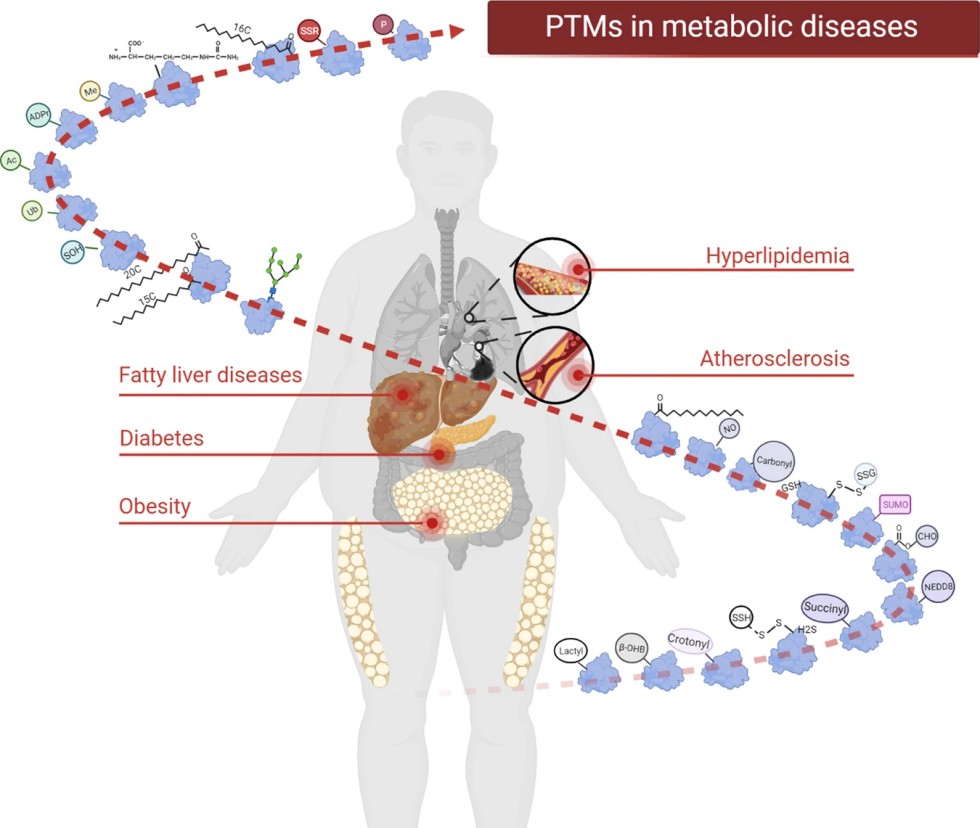 Post-translational modifications in metabolic diseases.