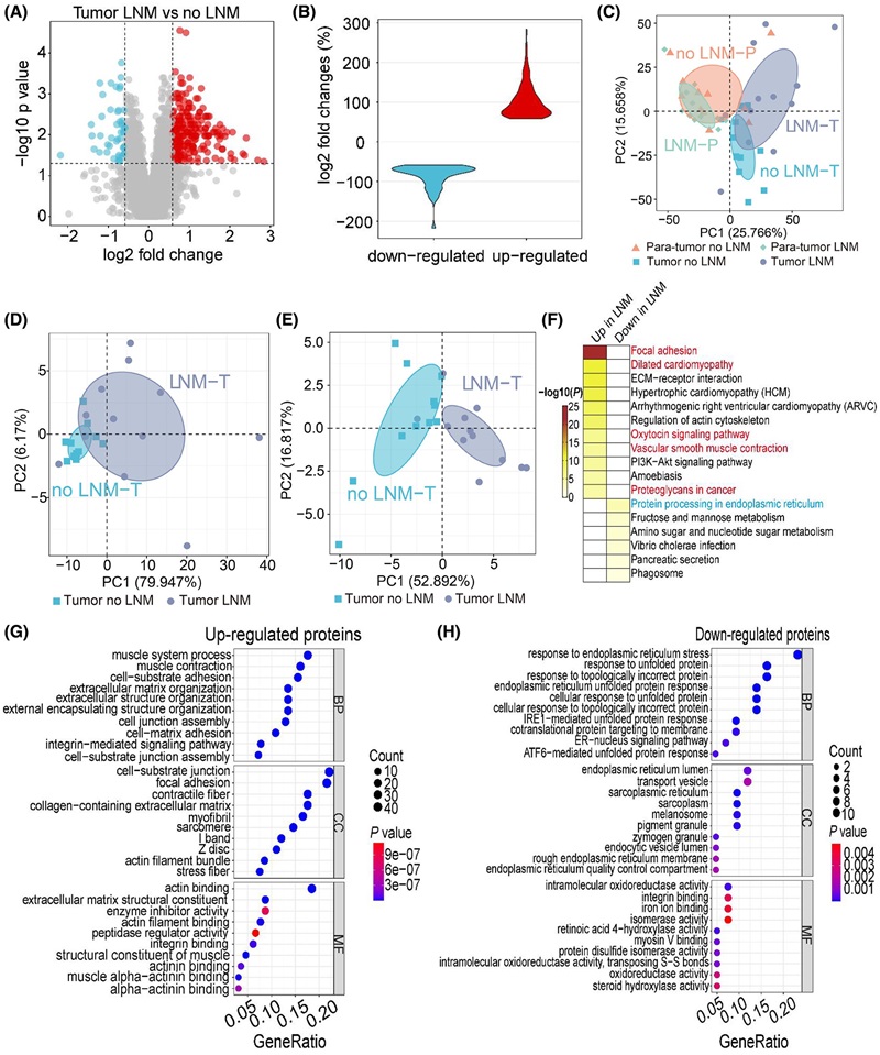 Quantitative proteomic comparison of patients with and without LNM.