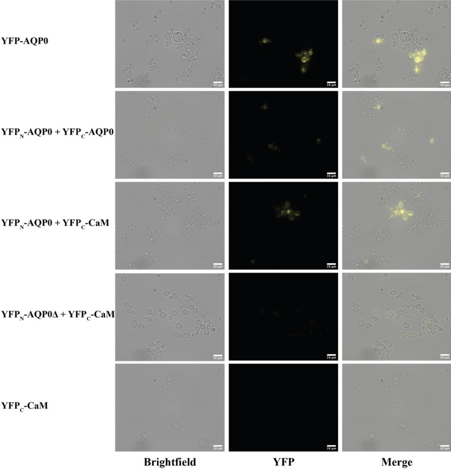 Bright field and fluorescence images of subcellular localisation of BiFC complexes produced.