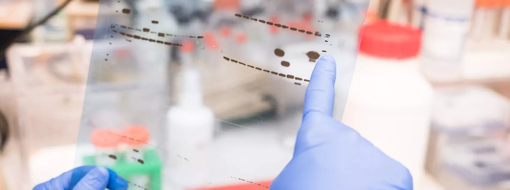 Microarray-Based PTM Analysis