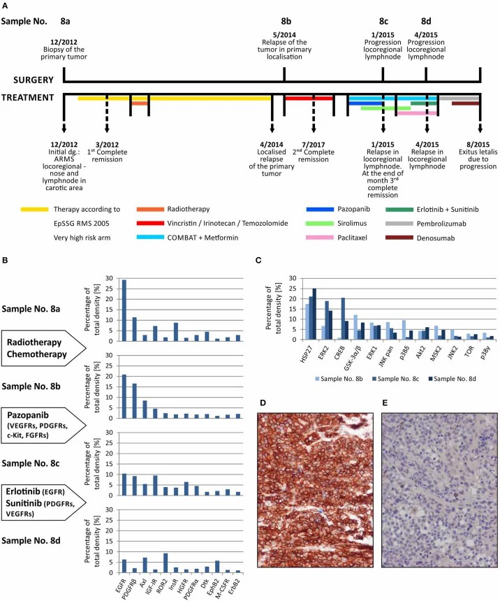 Sequential phospho-RTK array analysis of alveolar rhabdomyosarcoma across disease progression and treatment with pazopanib, erlotinib, and sunitinib (Neradil et al., 2019).