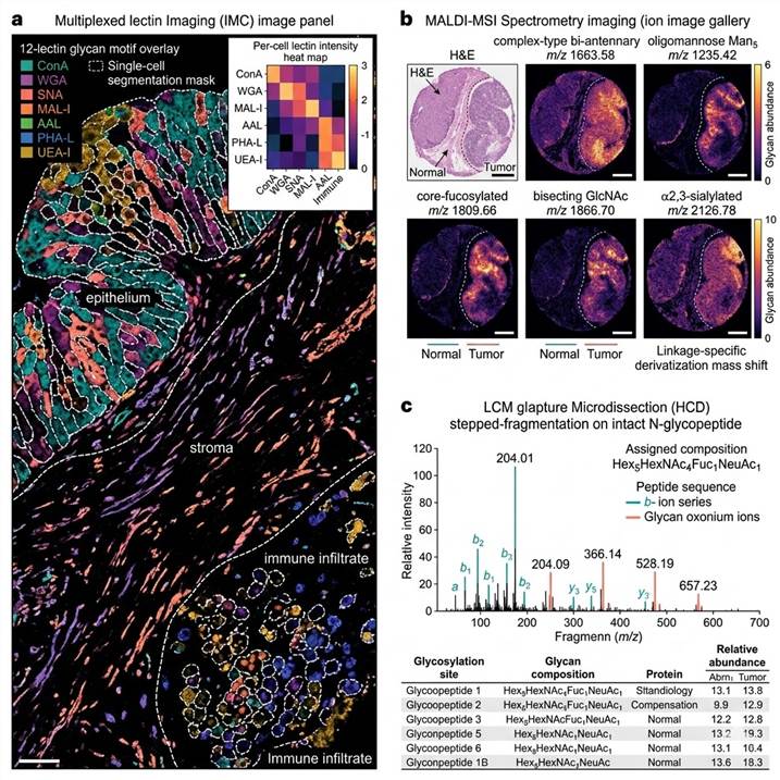 Representative spatial glycan profiling results panel: (Left) Multiplexed lectin IMC images of a cervical tissue section showing 12-lectin glycan motif overlay (ConA, WGA, SNA, MAL-I, AAL, PHA-L, UEA-I) with single-cell segmentation masks overlaid, demonstrating cell-type-specific glycan motif distribution patterns across epithelium (teal), stroma (coral), and immune infiltrate (purple) compartments. (Center) MALDI-MSI ion images for six representative N-glycan compositions (complex-type, oligomannose, core-fucosylated, bisecting GlcNAc, α2,3-sialylated, α2,6-sialylated) mapped across a tissue microarray core with matched H&E staining reference, showing spatially distinct glycan distributions between tumor and normal tissue regions. (Right) LCM glycoproteomics results showing an annotated HCD stepped-fragmentation MS/MS spectrum of an intact N-glycopeptide with assigned glycan composition (Hex5HexNAc4Fuc1) and peptide sequence identification, with a table summarizing identified glycosylation sites and their assigned glycan structures from the captured tissue region.