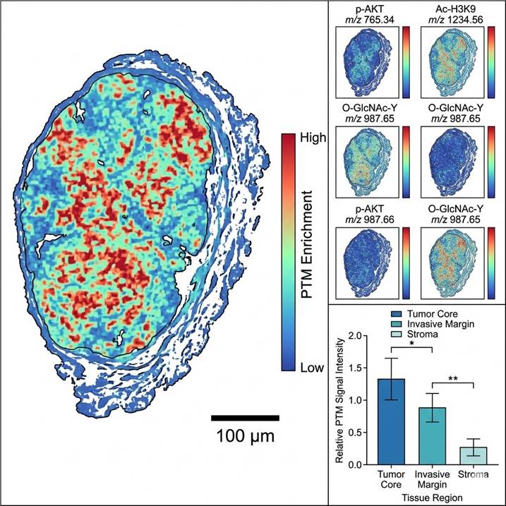 Spatial heatmap showing differential PTM enrichment across tumor core, invasive margin, and stromal regions with corresponding bar chart quantification.