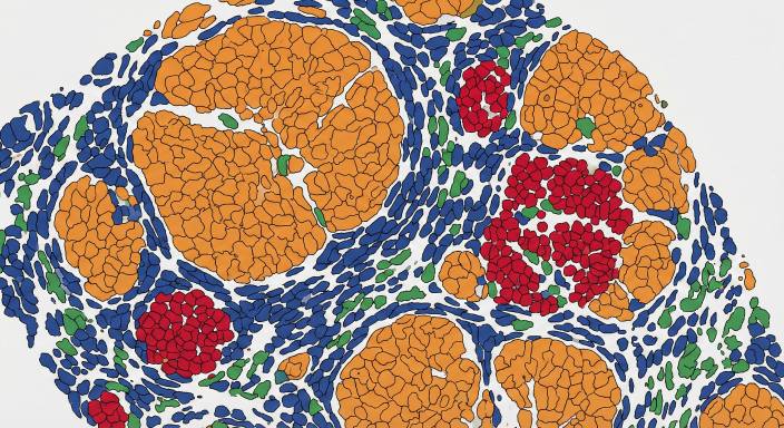 Segmented Voronoi map illustrating spatial clustering of distinct cell phenotypes like tumor, immune, and stromal cells.