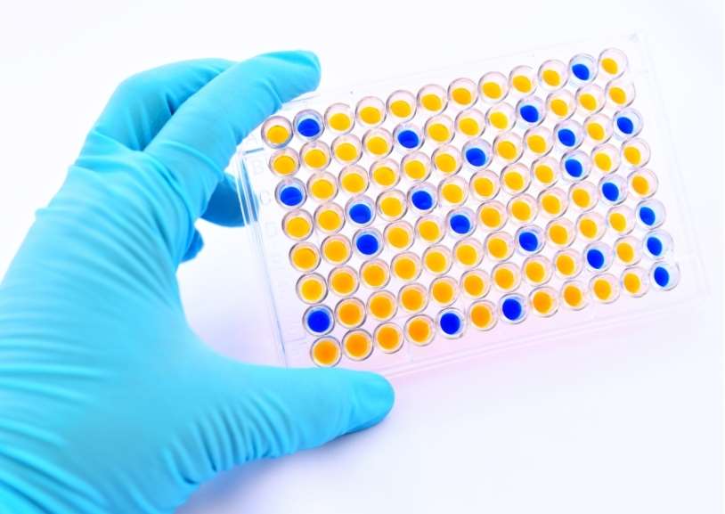 Immunoassay Development for Membrane Proteins