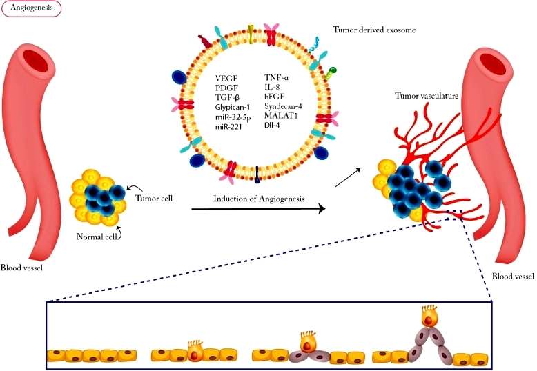 Tumor-derived exosomes promotes angiogenesis.