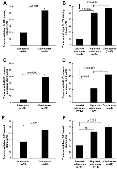 Quantification of glucose transporter type 1 (GLUT1) and prion protein (PrPC) immunohistochemical staining of TMAs