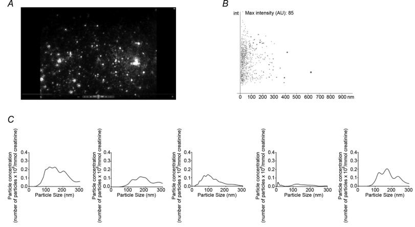 Nanoparticle tracking analysis (NTA) of human urine samples