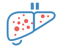 Liver Cancer