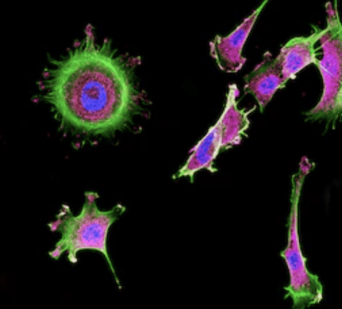 Preformed Tumor Cell Stably