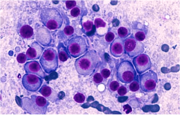 Screening of New Tumor Drug Targets / Markers