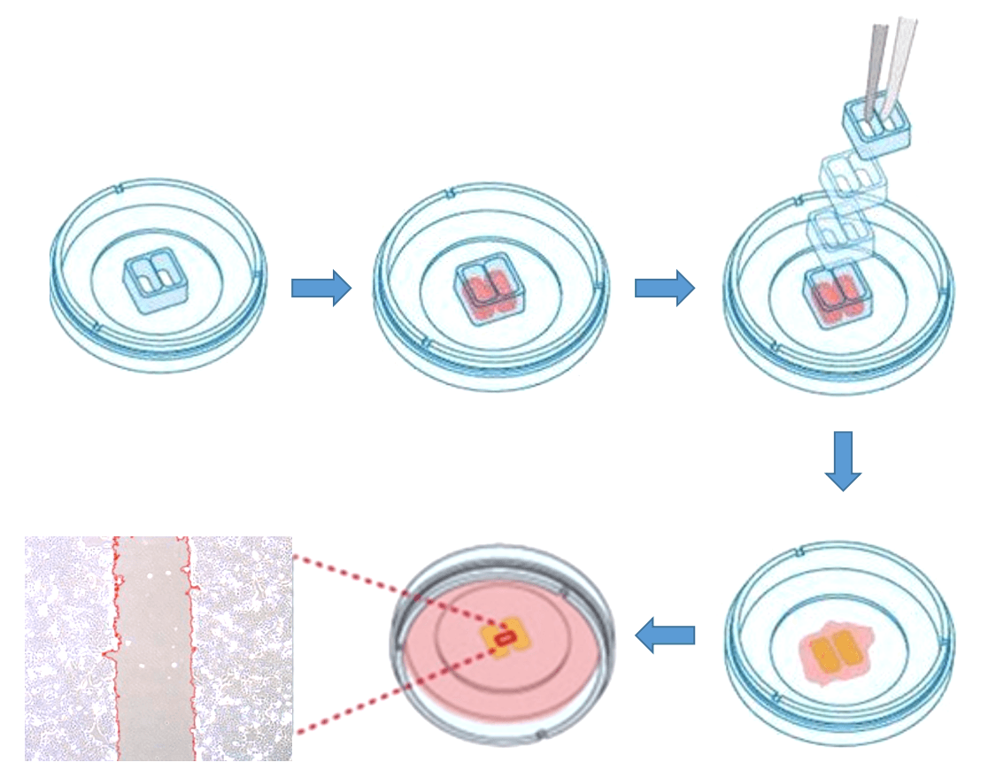 Tumor cell Scratch Test