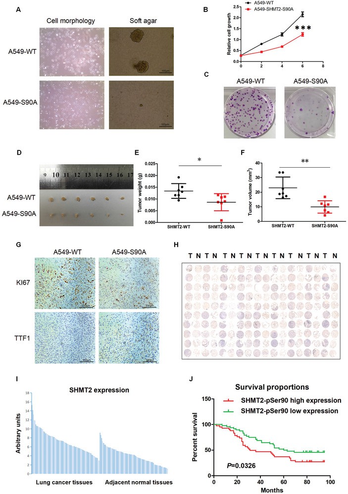 SHMT2‐Ser90 phosphorylation regulates LUAD cell tumorigenesis and is a potential diagnostic marker for LUAD.