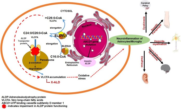 Case Study: Metabolomic Profiling of Very Long-Chain Fatty Acids in Neurological Disease