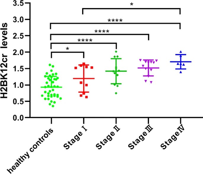 Association of H2BK12cr level with TNM stages of CRC.