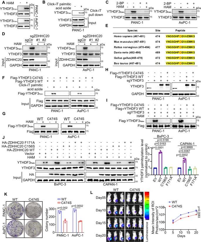 ZDHHC20 suppresses the degradation of YTHDF3 via palmitoylation on Cys474.