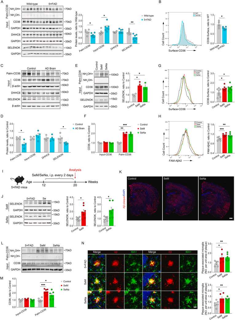Se enhances CD36 palmitoylation and microglial Aβ phagocytosis in AD.