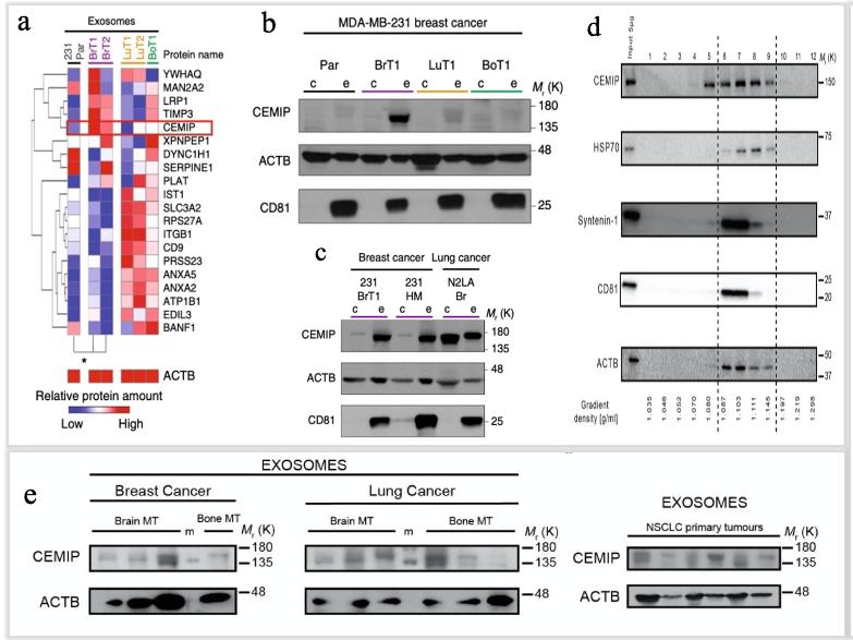 Exosomes from brain metastatic cells support brain metastatic colonization and are enriched in CEMIP protein