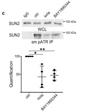 ATR signalling is required for survival in ALK-driven NB cell lines