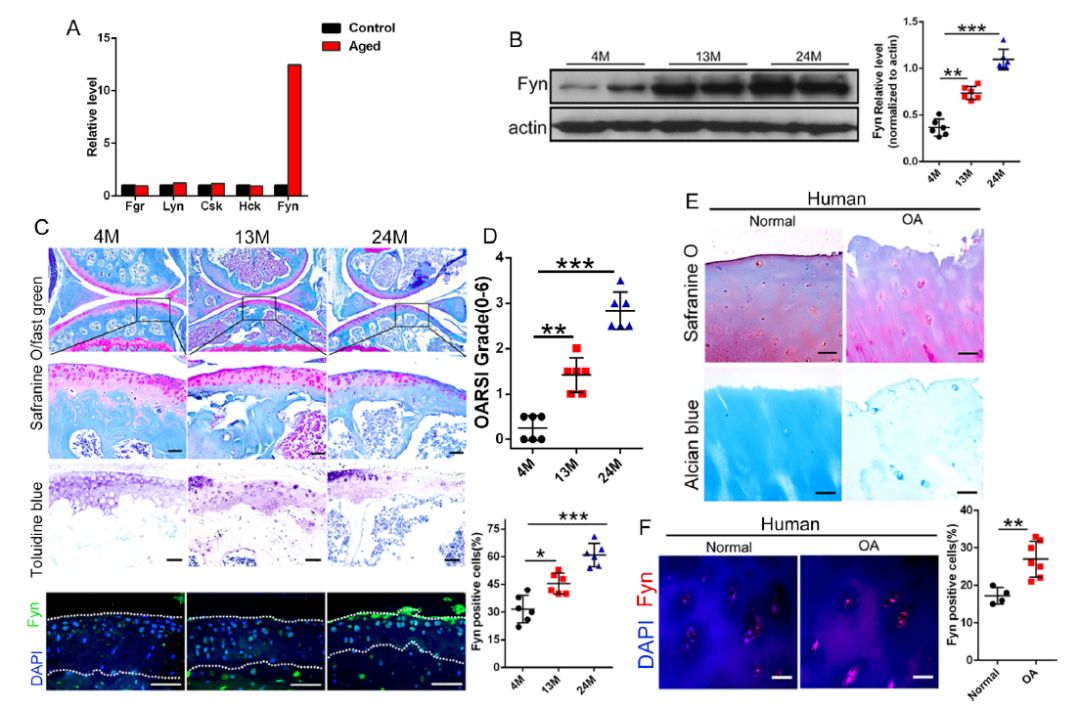 Discovering New Disease Markers through Exosome Proteomics