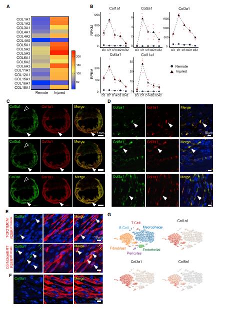 Unlocking the Secrets of Myocardial Infarction through Proteomic Analysis: Insights into Pathogenesis and Therapeutic Opportunities