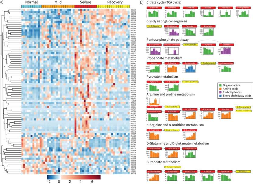 Figure 2 Changes in major serum metabolites found at different stages of the cohort. (A) Heat map of metabolites quantified by targeted metabolomics; (B) Pathway analysis showing significant differences in amino acid metabolism