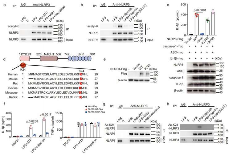 Acetylation Regulation in Inflammation: Insights from NLRP3 and SIRT6 Studies