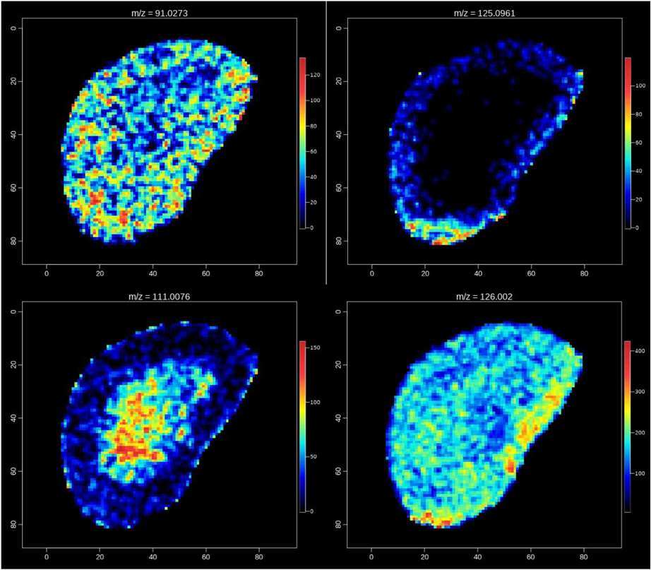 Imaging images of several metabolites in negative ion mode
