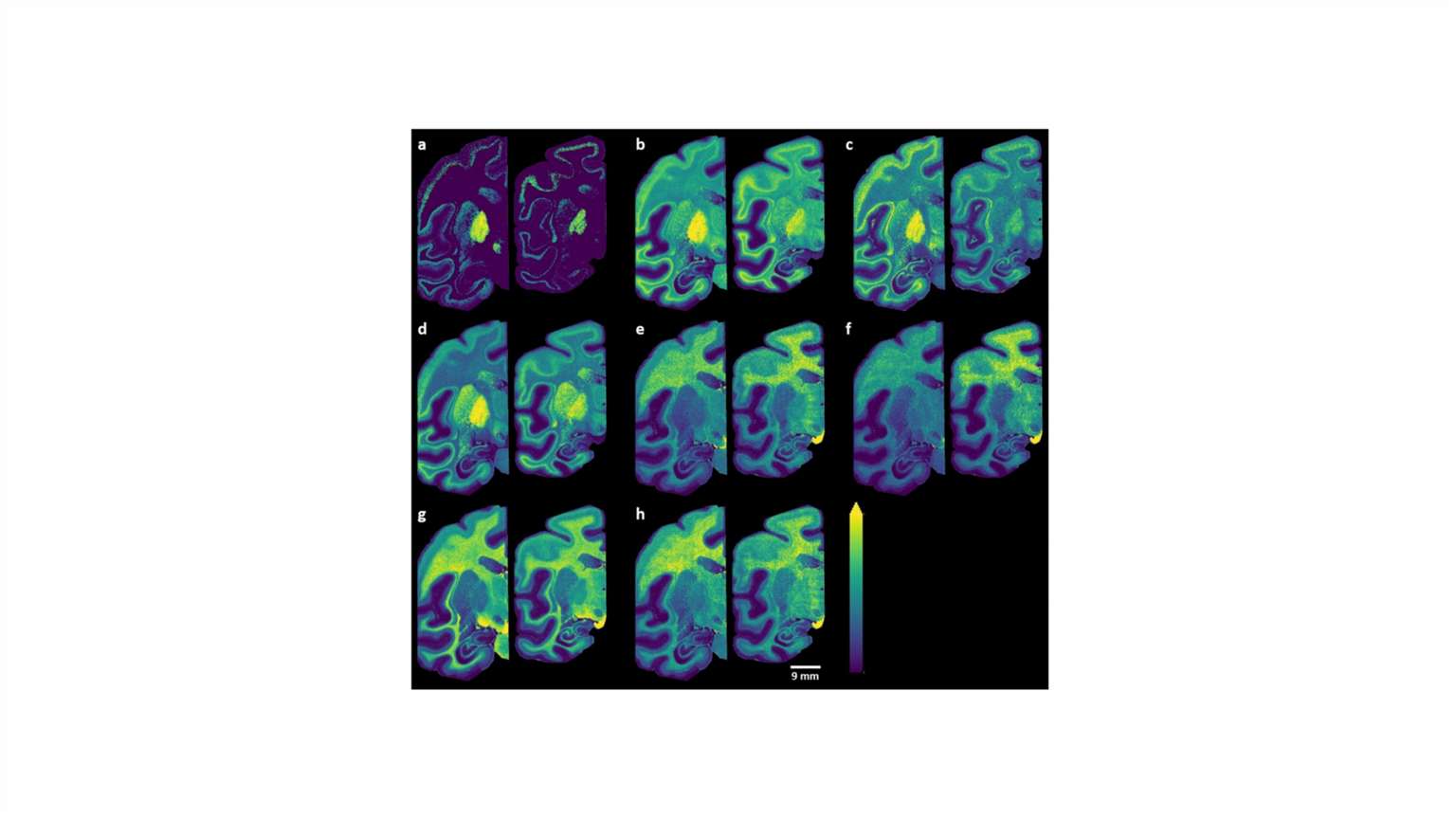 sulfatides MALDI-MS ion distribution image