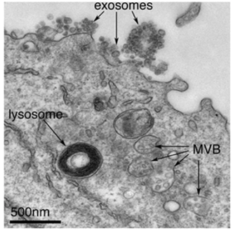Exosomes correspond to intraluminal vesicles of multivesicular bodies