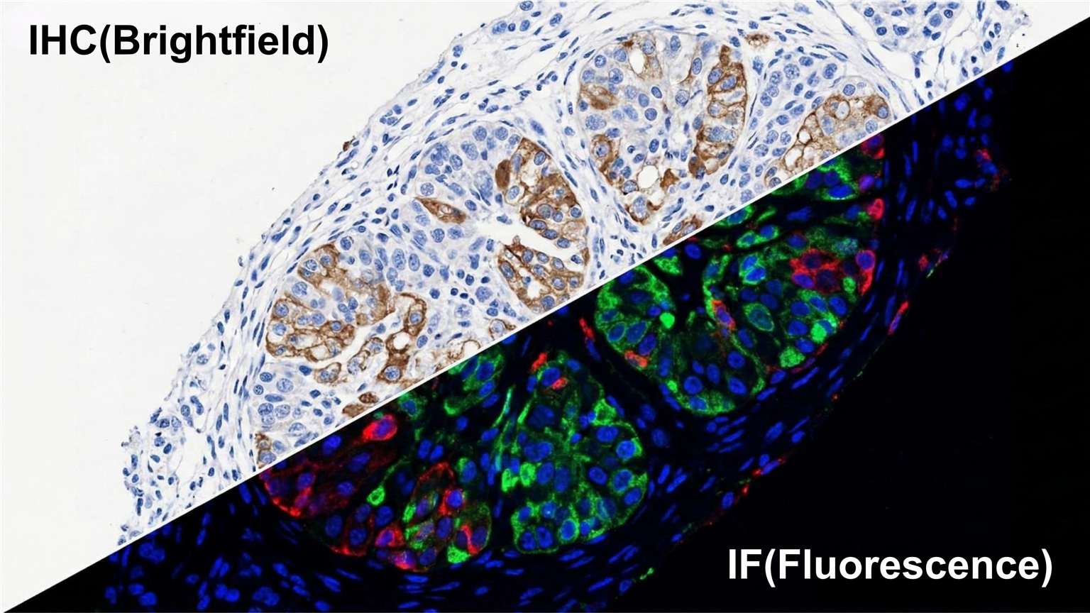 IHC and IF overview