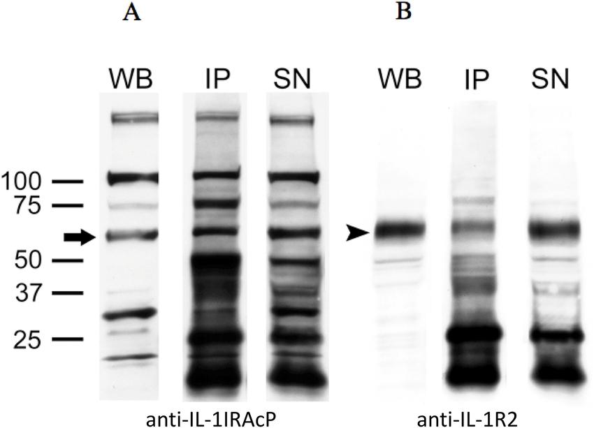 Immunoprecipitation-Western Blot (IP-WB) Experiments: Procedures and Result Analysis