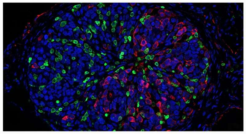 In situ hybridization for Oncology