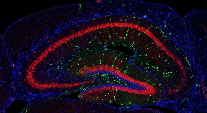 In situ hybridization for Neurology