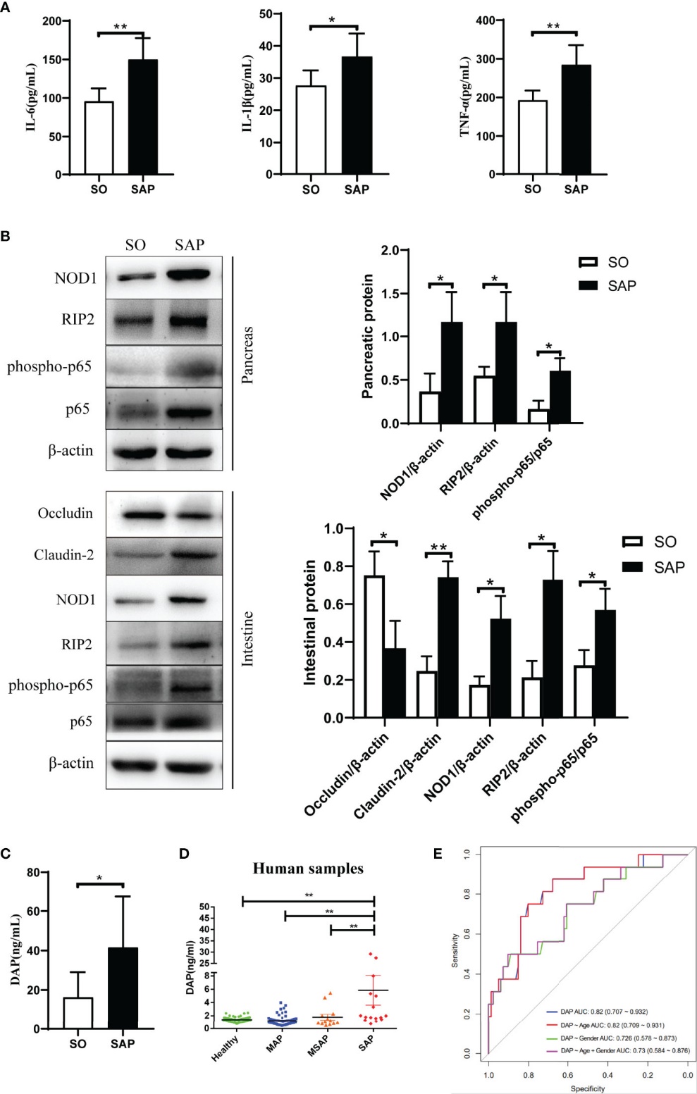 Increased inflammatory cytokines, NOD1 signaling proteins, and serum DAP levels in SAP rats and patients. Serum DAP effectively differentiates severe from mild/moderate acute pancreatitis.