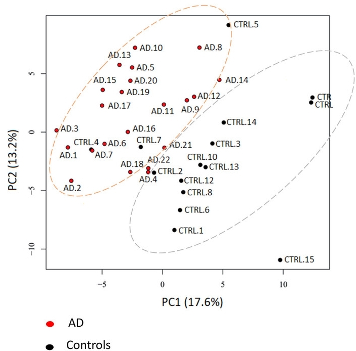 PCA representing clear proteomics profile differences between AD patients (red solid circles) and controls (black solid circles).