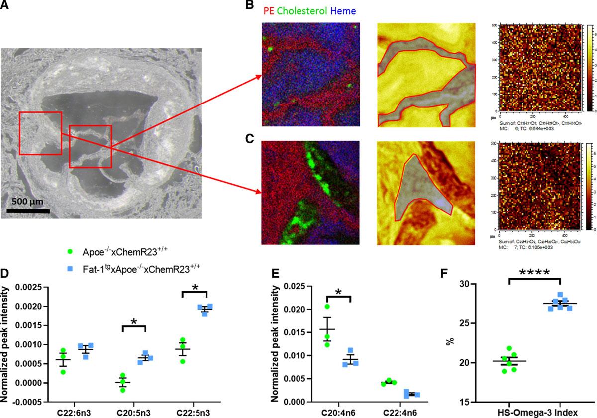 Omega-3 polyunsaturated fatty acids (PUFAs) are higher and n-6 PUFAs are lower in valve leaflets of Fat-1tg×Apoe−/− compared with Apoe−/− mice.
