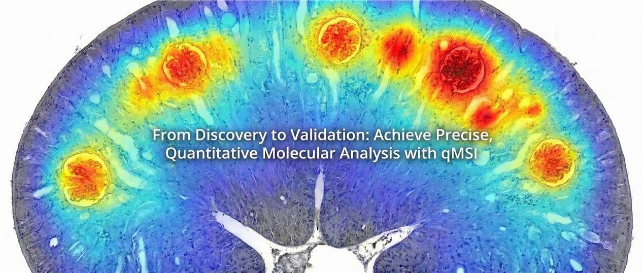 Unlock the Power of qMSI