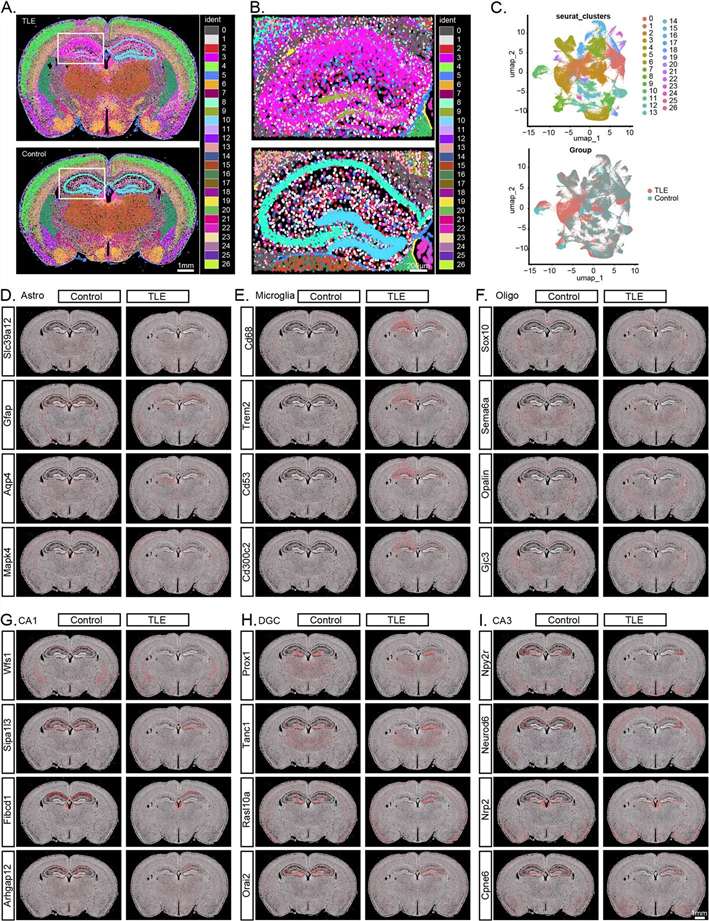 single-cell level spatial transcriptomics analysis