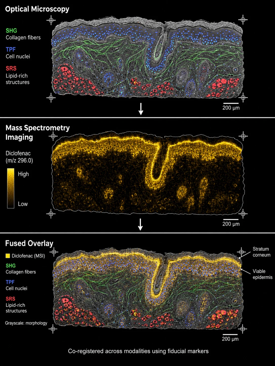 Correlative Imaging — Raman/SHG + MSI + H&E Overlay for Multi-Modal Drug Visualization
